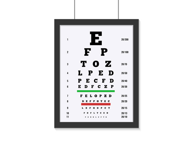 Examen de Agudeza Visual